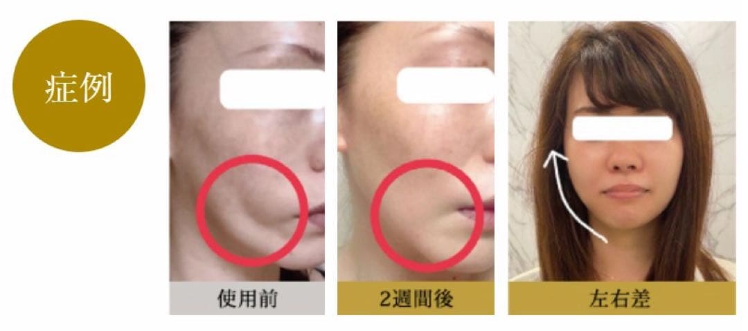 【新品未使用】高機能マルチ美容液　フェイススリムブースターセラム 40mL