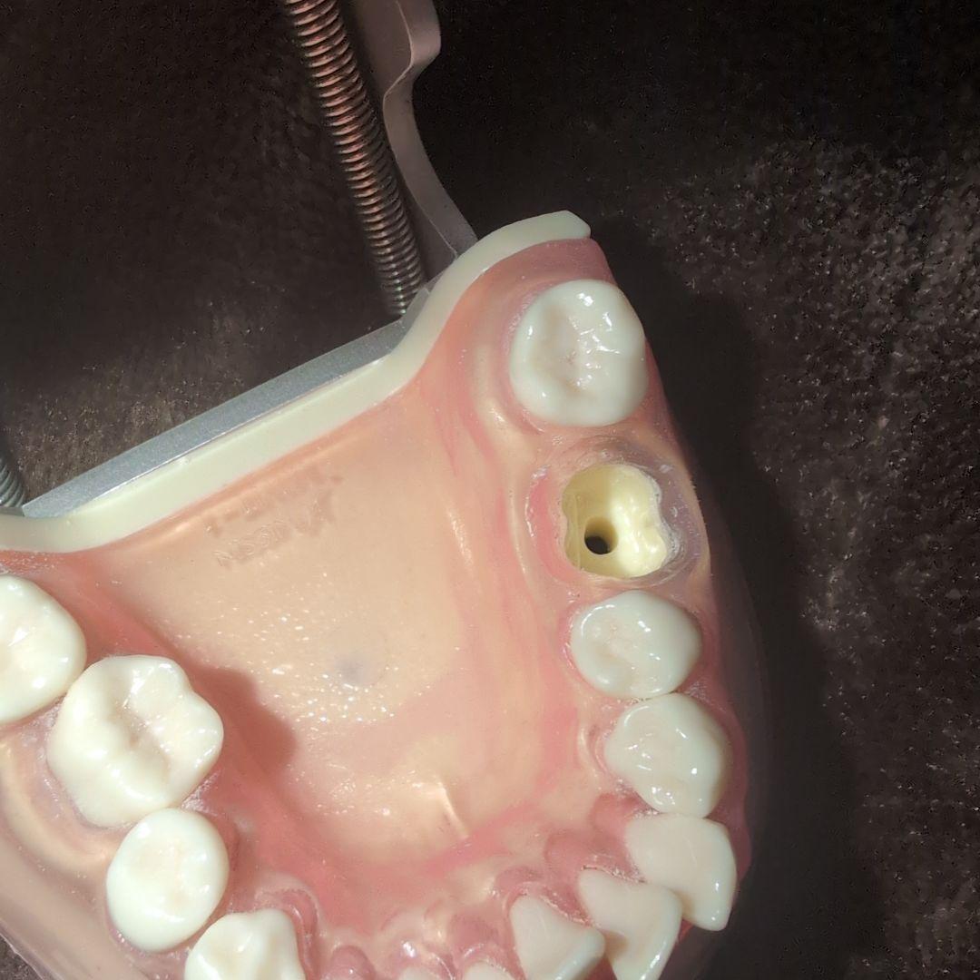 さがしもの NISSIN 歯科模型　顎模型 DENTAL