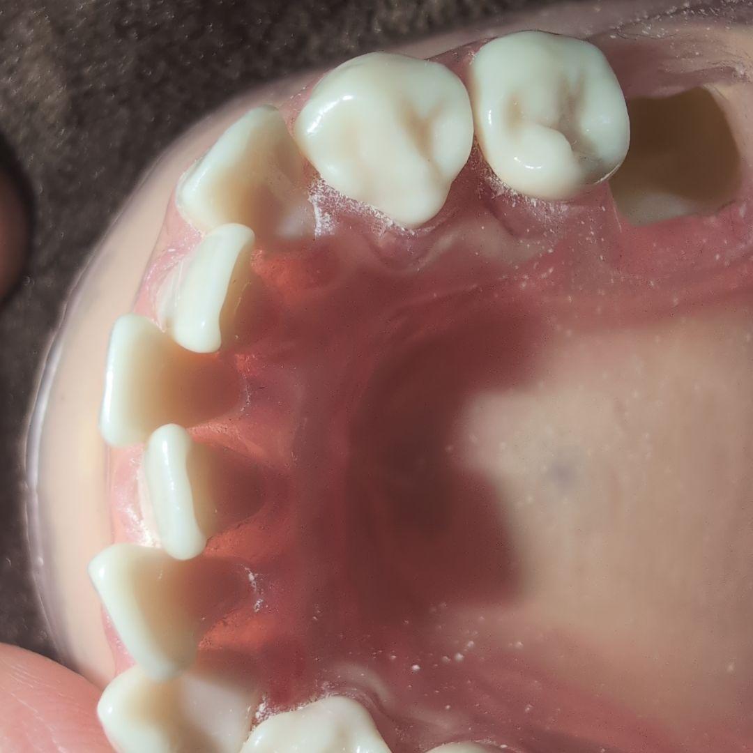 さがしもの NISSIN 歯科模型　顎模型 DENTAL