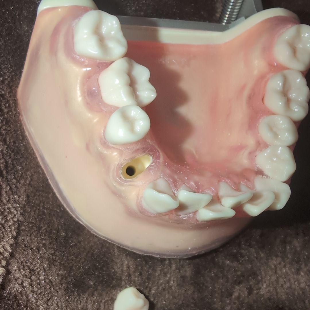 さがしもの NISSIN 歯科模型　顎模型 DENTAL