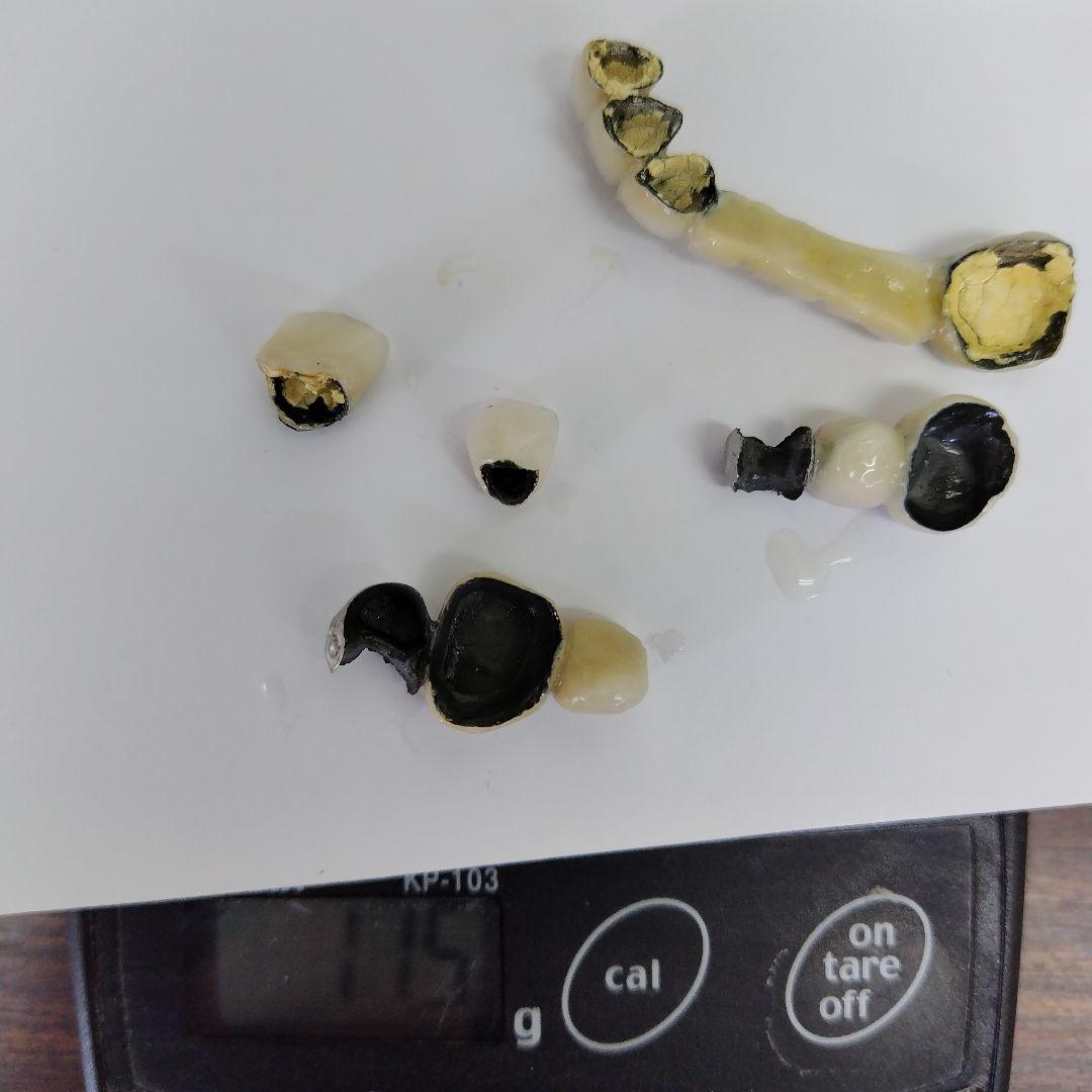 歯科用セラミック撤去かん