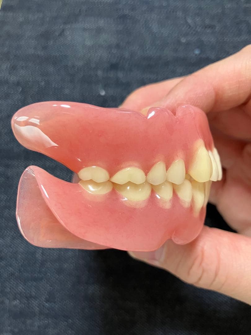 歯科 技工 フルデンチャー