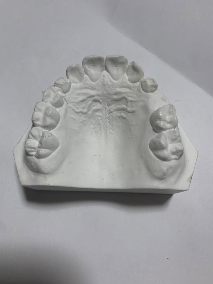 小児　入れ歯　顎模型