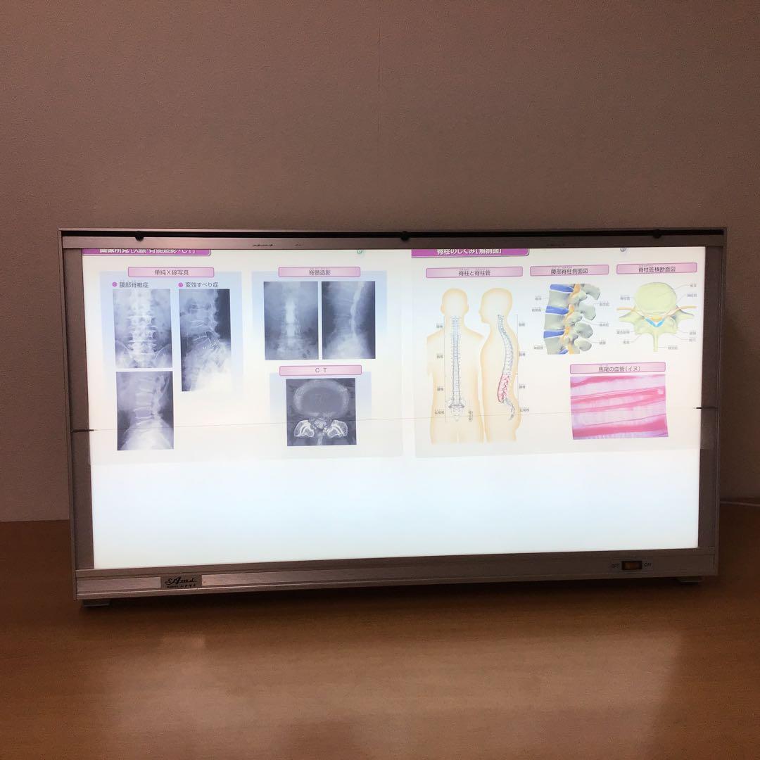 シャウカステン（シャーカステン）＋脊柱管説明フィルムセット