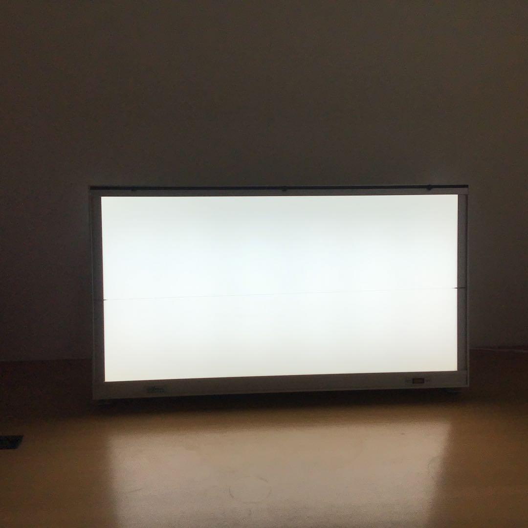 シャウカステン（シャーカステン）＋脊柱管説明フィルムセット