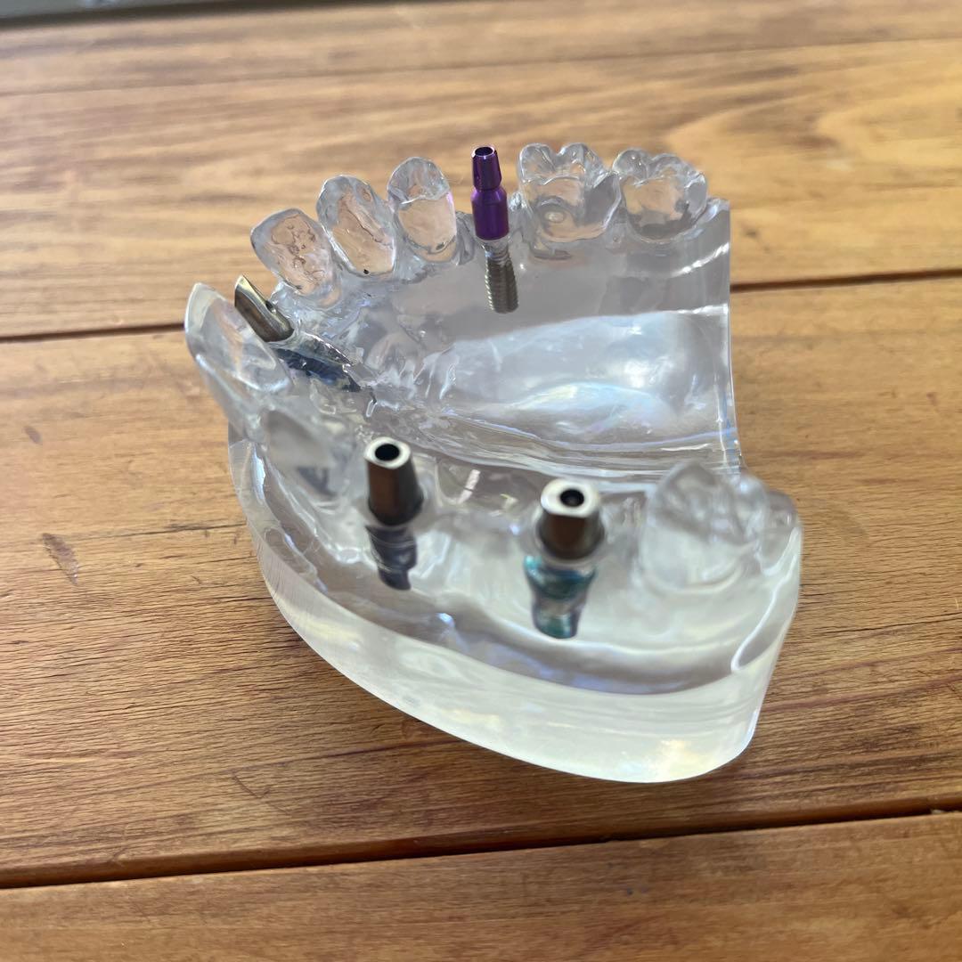 camlog カムログ　インプラントの模型