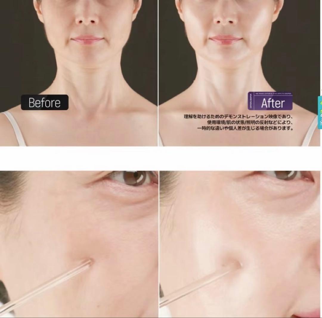 未開封シワ特化DIFFER&DEEPERピエルトラファミングバンドC50g×2個