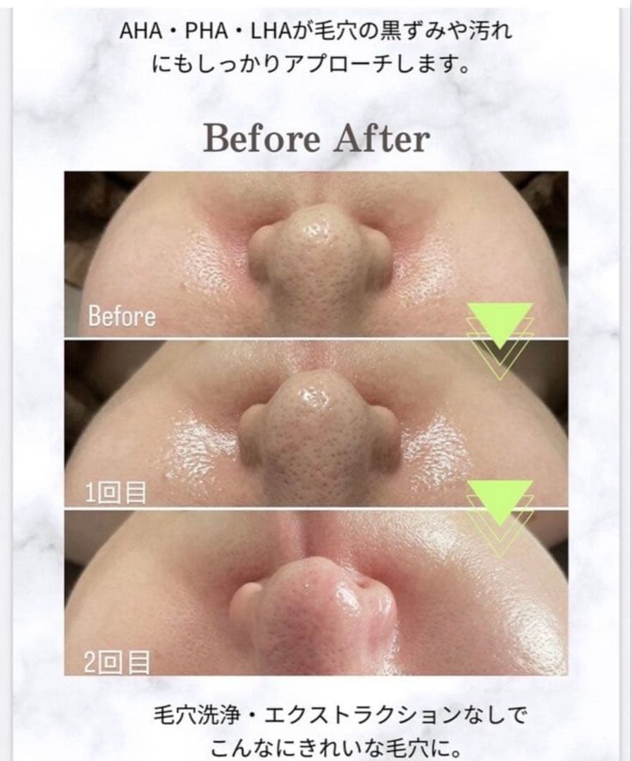 ラミネーションピール　ラミピール　20人分　新品未使用