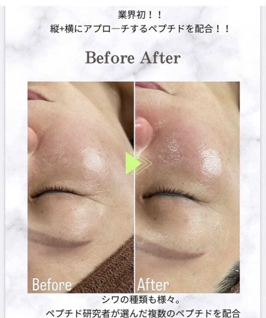 ラミネーションピール　ラミピール　20人分　新品未使用