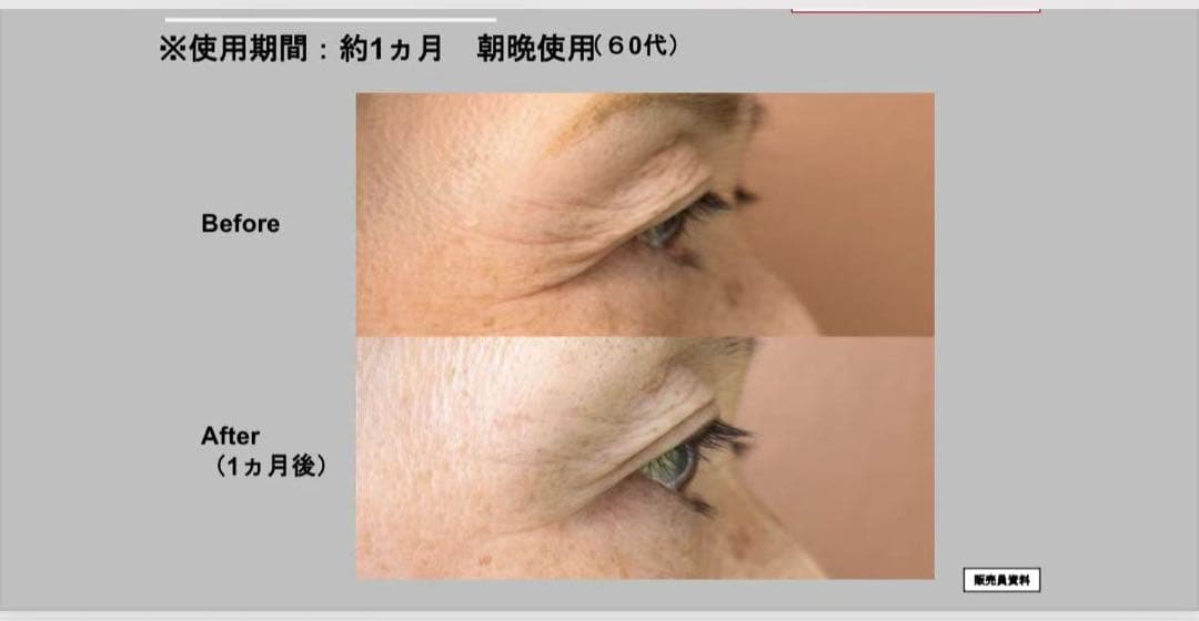 新品ナリスセルグレースフォーミュラI・II セット*3最高峰エイジング