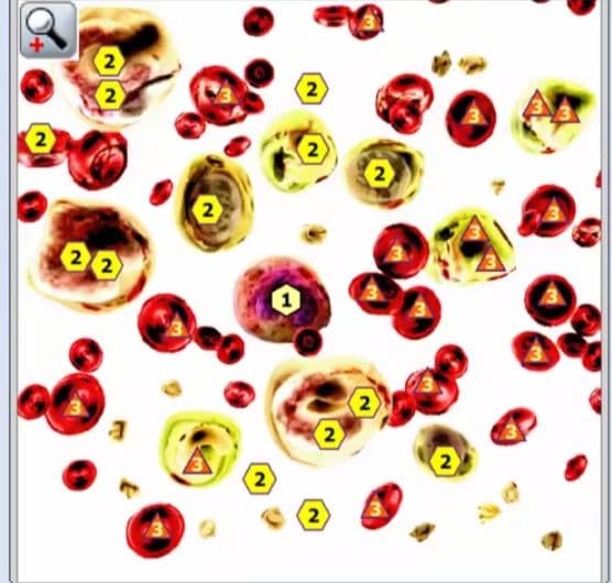 期間限定セール☆波動測定器18D NLS メタトロン ニュースキャン