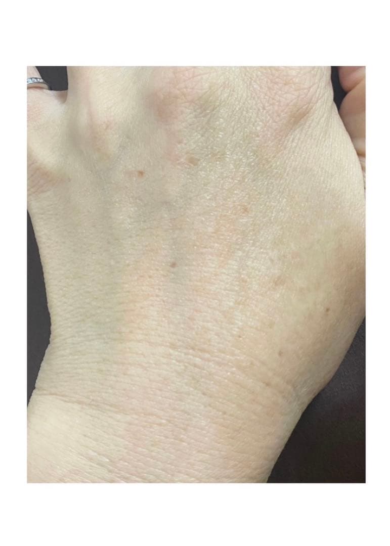 炭酸パック（お得用３箱セット）スパークリング ワンジェル